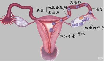 输卵管积液