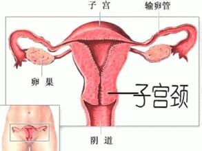 多囊卵巢