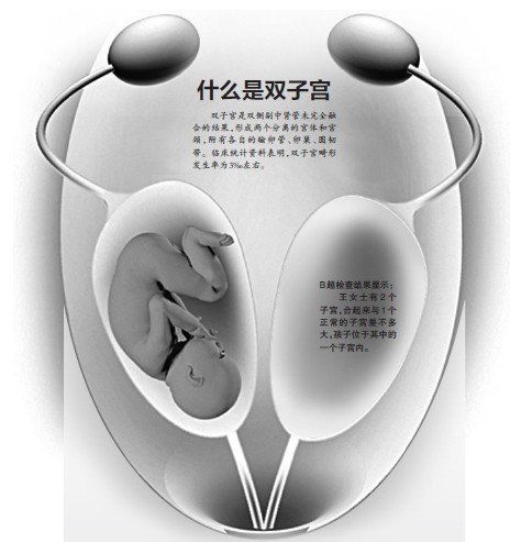 双子宫
