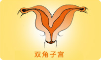 双角子宫