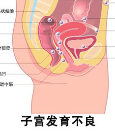 子宫发育不良