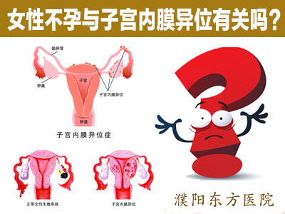 子宫内膜异位