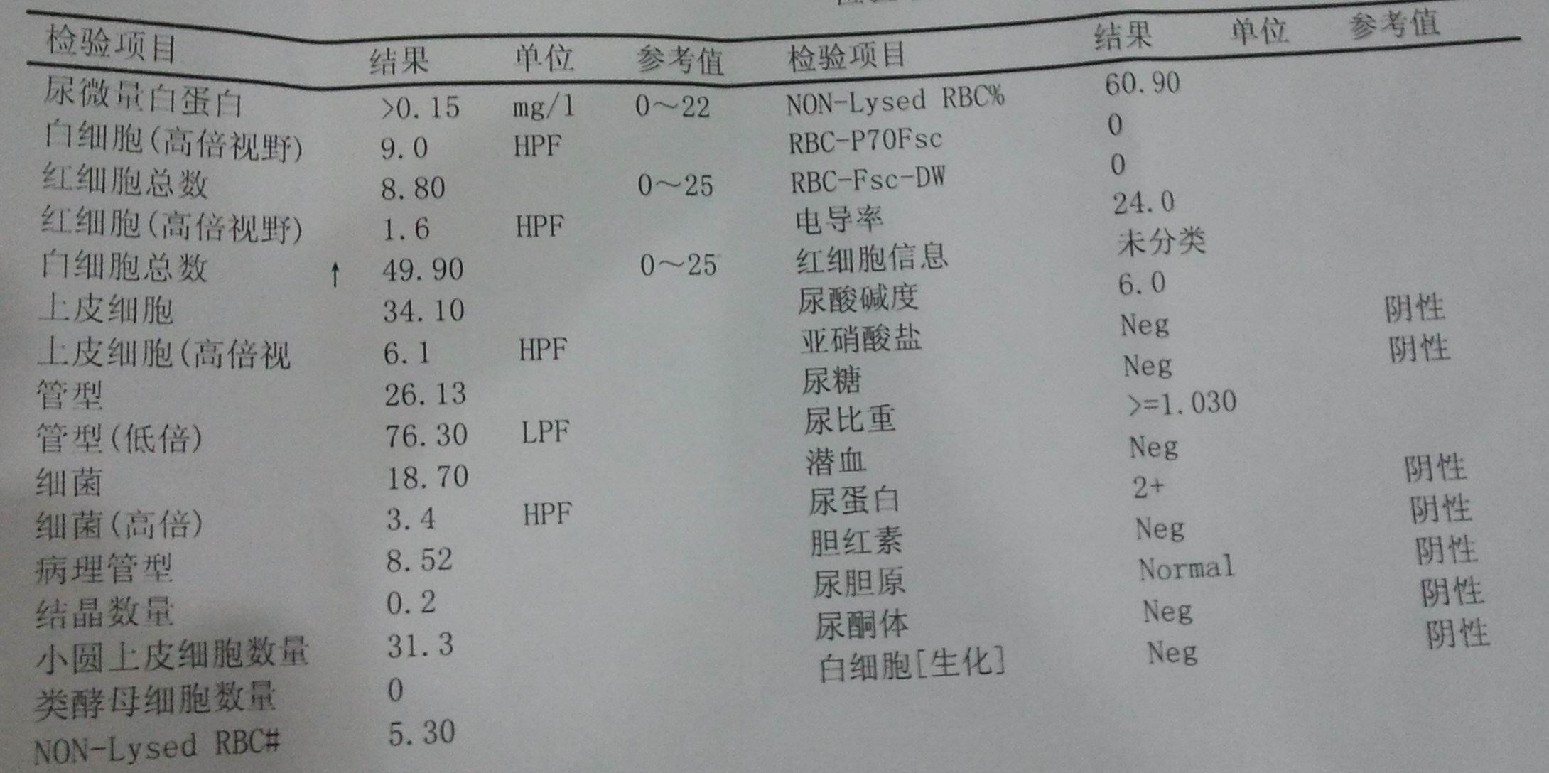 精索静脉曲张检查报告
