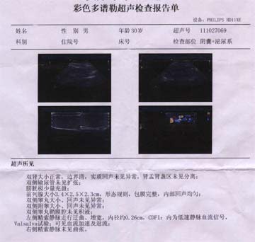 精索静脉曲张检查报告