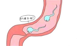 什么原因输精管堵塞