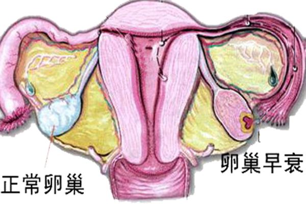 卵巢早衰的危害有哪些