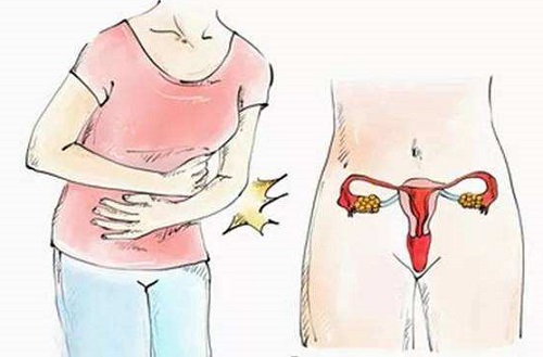畸形子宫影响怀孕吗